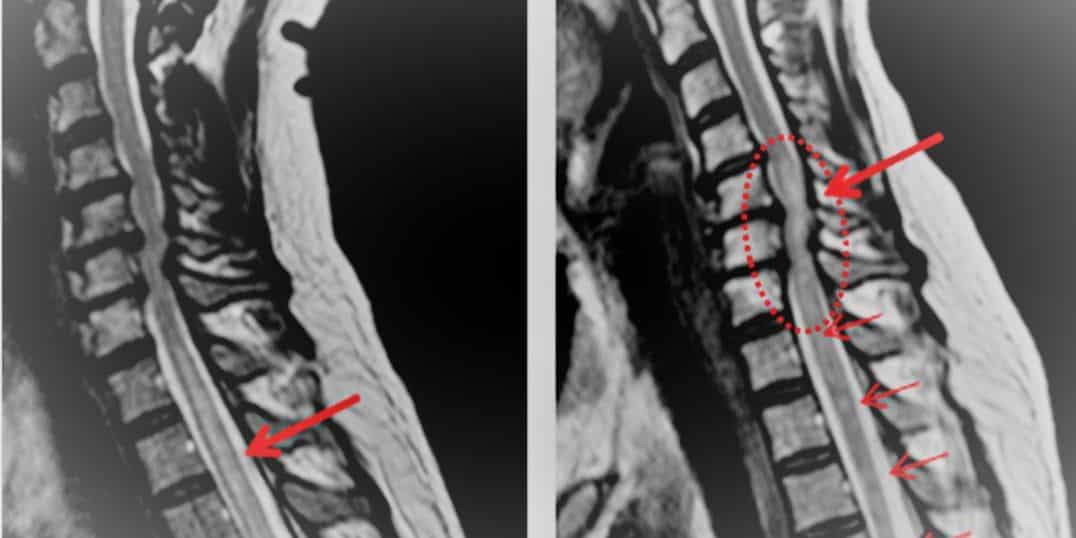 xray-tm-comparison